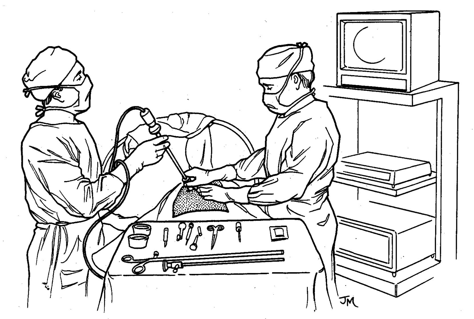 thoracoscopie op de operatiekamer